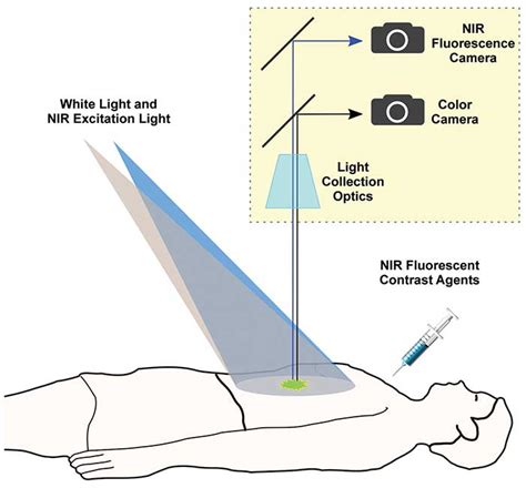 Fluorescence Imaging Enters The Surgical Suite Features Mayjun
