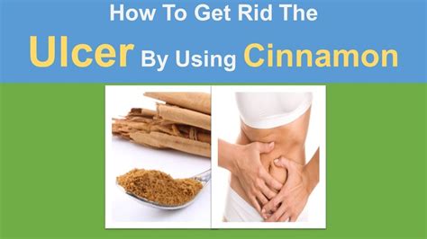 How To Get Rid The Ulcer By Using Cinnamon Home Remedy For Ulcer Tips