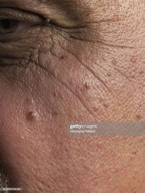 Age Spots And Wrinkles On Senior Mans Skin Closeup High Res Stock Photo