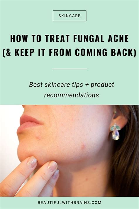 How To Treat Fungal Acne Beautiful With Brains