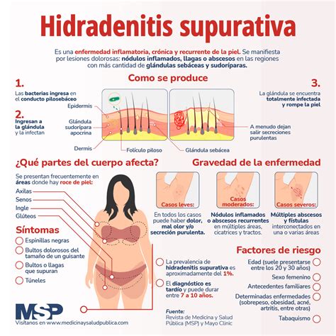 Hidradenitis Supurativa Infografía