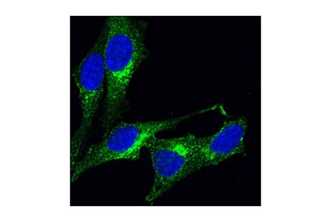 We did not find results for: Clathrin Heavy Chain (P1663) Antibody | Cell Signaling ...
