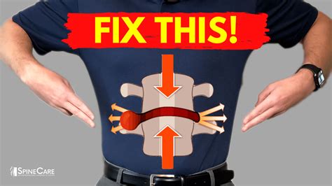 How To Relieve A Lower Back Bulging Disc In SECONDS SpineCare