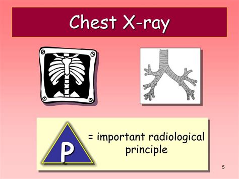 Ppt Principles Of Chest X Ray Interpretation Powerpoint Presentation