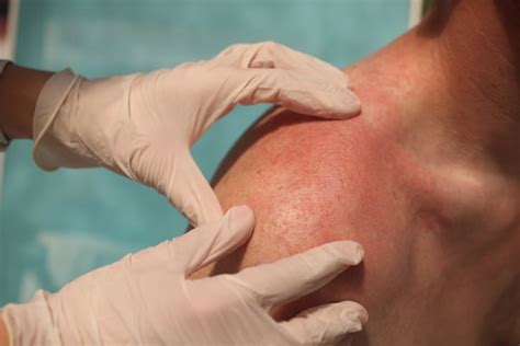 10 Ways To Repair Sun Damaged Skin VitalSkin Dermatology