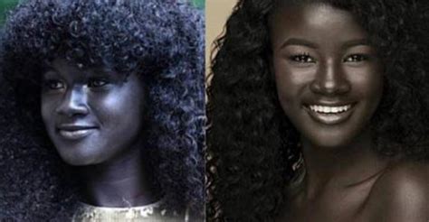 They Bullied Her For Her Incredibly Dark Skin Color Now She Is A Model