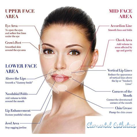 What Is The Difference Between Botox And Filler Elemental Esthetics