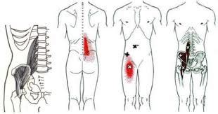 Potentially, that could also be a source of low back pain. Gina McCafferty, LMT: Low Back Pain.: A look at Structural ...