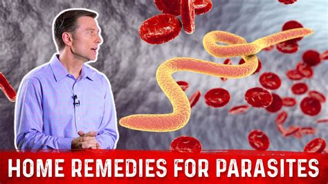 Best Home Remedies For Parasites Dr Berg Youtube