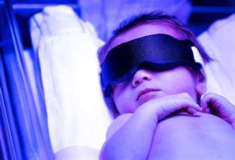 Phototherapy For Treating Neonatal Jaundice Process Risks Complications