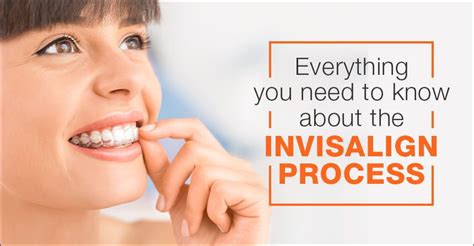 Everything You Need To Know About The Invisalign Process Smilex
