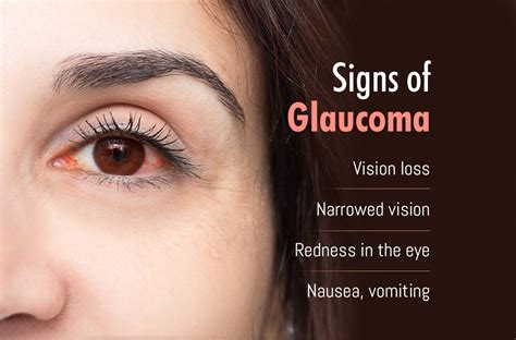 Glaucoma Pathophysiology And Detection Glaucoma Human Eye Images