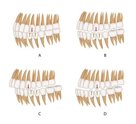 Dental Occlusion Geeky Medics