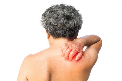 Your Basic Guide To Treating Long Term Shingles Pain — Pain Management
