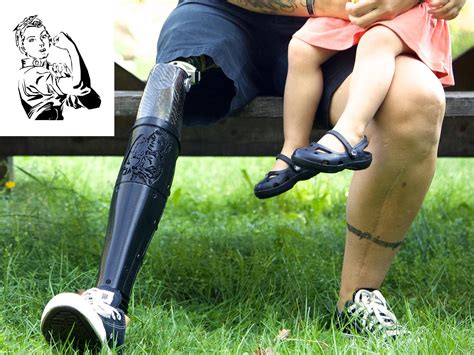 Create Prosthetics Enables Amputees To Design Their Own Unique 3d