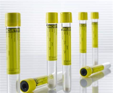 Greiner Bio One Vacuette Urine Ccm Tubes Capacity Metric Ml Bottom
