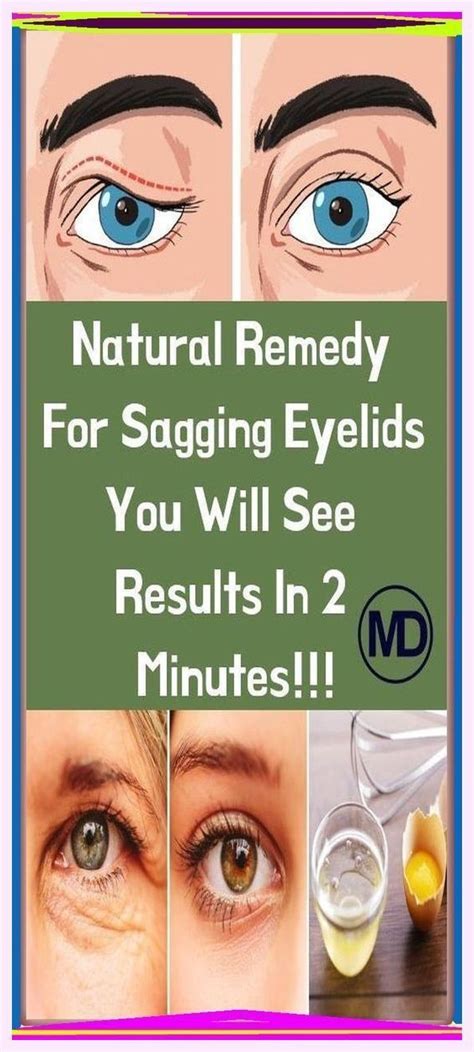 Natural Remedy For Sagging Eyelids You Will See Results In 2 Minutes