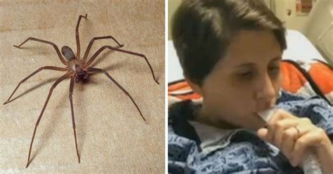 Woman Recovering From Bite After Finding 50 Recluse Spiders In Her Bedroom