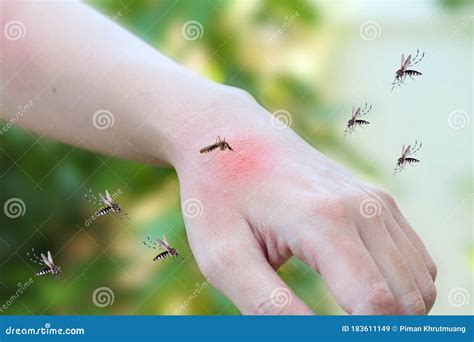 Mosquitoes Bite On Adult Hand Made Skin Rash And Allergy With Red Spot