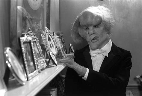 Born with a congenital disorder, merrick uses his disfigurement to earn a living as the elephant man. The Elephant Man - Film | Park Circus