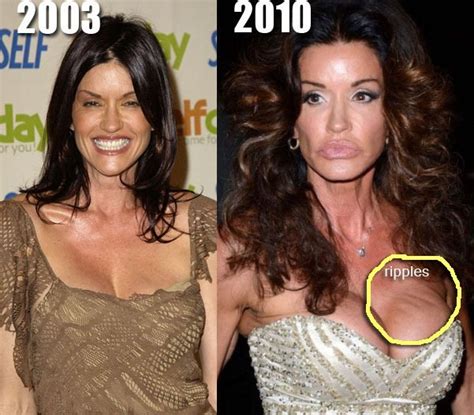 Worst Celebrity Breast Implants Notoriously Bad Boob Jobs Cosmetic Plastic Surgery