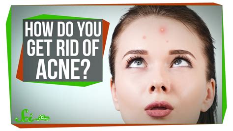 However, you can help manage it by using warm water and soap to gently clean the skin. » How Do You Get Rid of Acne?