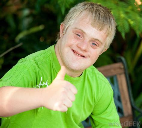 crowdfunding to help dave who has a rare type of down syndrome which is called mosaic down