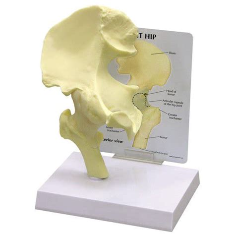 Health Management And Leadership Portal Elbow Anatomical Model