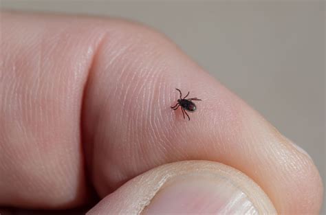 Cdc Connects Red Meat Allergy To Certain Tick Bites Wcmu Public Radio