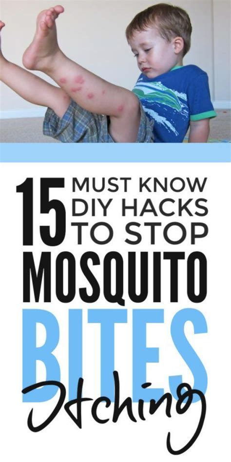 80 Best Of How To Treat Mosquito Bites On Babies Insectza