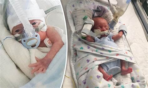 Miracle Premature Baby Survives Being Born At Just 22 Weeks Uk