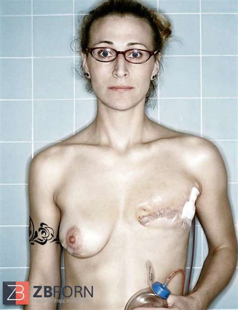 Amputee Mastectomy Handicapped Zb Porn