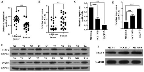 demethylation of mir 495 inhibits cell proliferation migration and promotes apoptosis by
