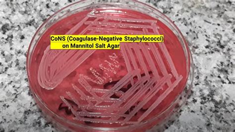Cons Colony Morphology On Mannitol Salt Agar Youtube