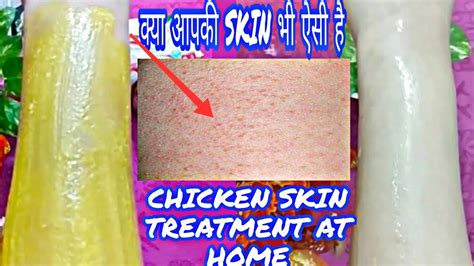 How To Get Rid Of Chicken Skin Treatment At Home । क्या आपकी Skin पर