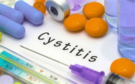 What Is Interstitial Cystitis Symptoms Causes And Treatment