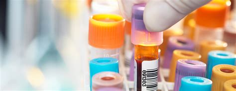Clotting is important to help prevent too much bleeding. Partial thromboplastin time (PTT)