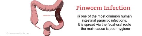 Pinworm Thread Worm Infection Causes Symptoms Diagnosis
