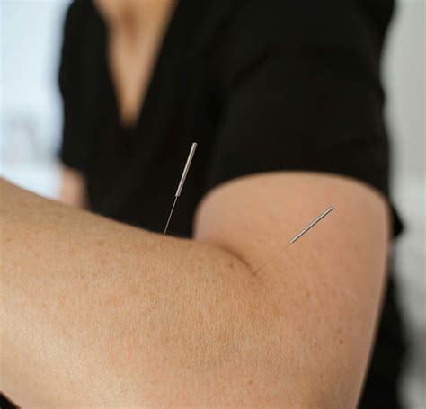 Blog — Kate Duggan Acupuncture And Naturopathy