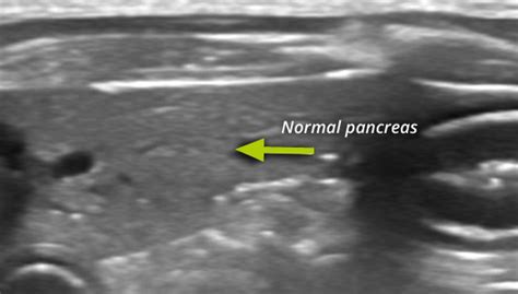 Pancreatitis In Dogs Ndsr