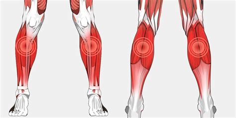 Anterior leg musclesfigure 1 : Lower Leg Pain - The Complete Injury Guide - Vive Health
