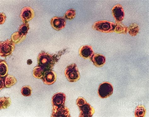 Varicella Zoster Virus Particles Tem Photograph By Ami Images Fine