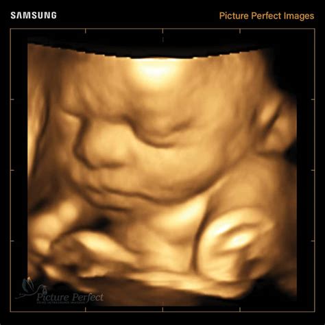 Home Picture Perfect 3d4d Ultrasound