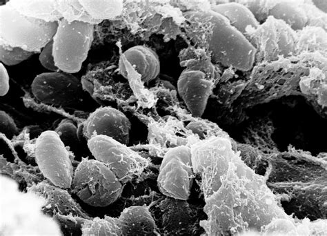 Case Of Bubonic Plague Reported In Inner Mongolia Nerdist