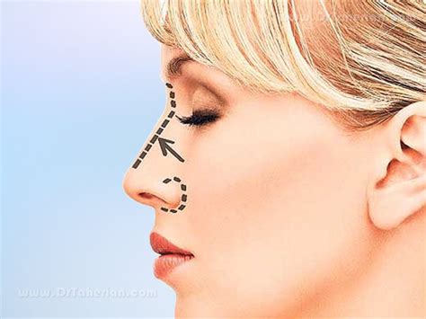 Ideal Nose Characteristics Measures Of Beautiful Nose