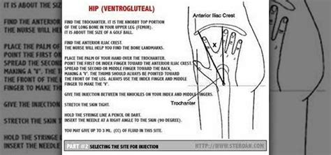 im injection sites ventrogluteal diagram