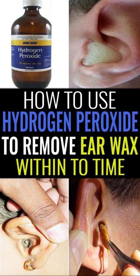 One should remember, that ear buds are dangerous and one should. How To Use Hydrogen Peroxide To Remove Ear Wax? in 2020 ...