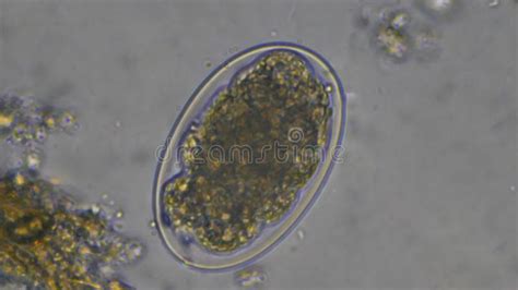 The parasite stool test can be the most effective test for common parasite infections. Egg parasite. stock image. Image of agriculture, nematoda - 67925955