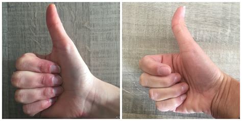 Is Your Thumb Straight Or Crooked This Is What It Can Tell You About