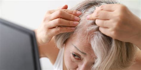 Scabs On Scalp Causes And Treatments According To Doctors